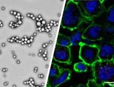 Biocompatible nanoparticles enhance systemic delivery of cancer immunotherapy